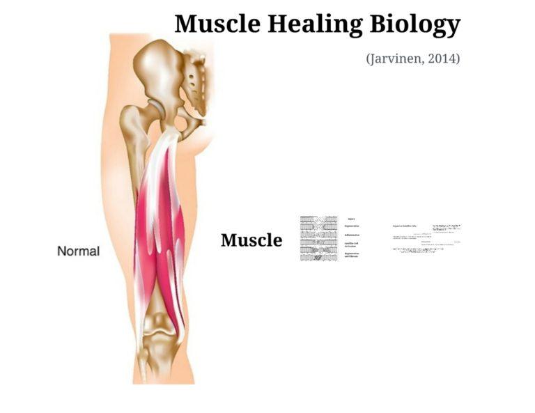 dance injury hamstrings essay Case study: hamstring grade ii tear of right posterior thigh pain following a football injury at the applied to the right hamstrings to encourage. dance injury hamstrings essay Case study: hamstring grade ii tear of right posterior thigh pain following a football injury at the applied to the right hamstrings to encourage.