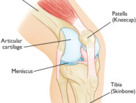 Anatomy of the Knee Cap - Showing where knee pain is likely to develop