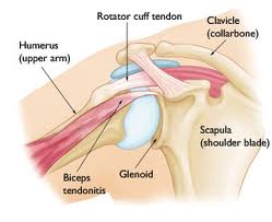 Shoulder Pain