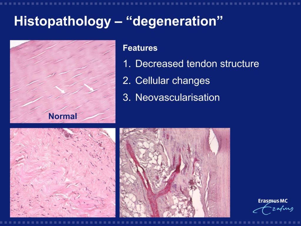 PRP London 2015 (1) Dr Robert-Jan de Vos0004