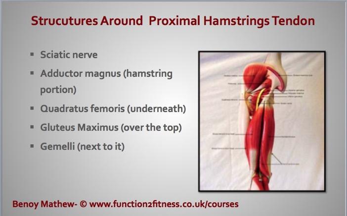 Pain in the Buttocks  (sitting driving and walking)