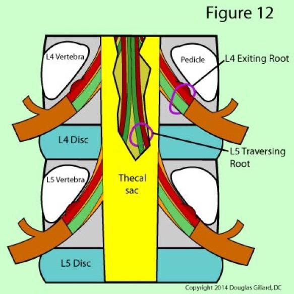 Low Back Pain  concerns about sitting  causing early degeneration and wear and tear on your Lumbar joint facets and potentially increasing the risks of herniated Discs