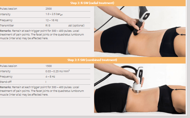 Low Back Spinal Pain  with shockwave therapy