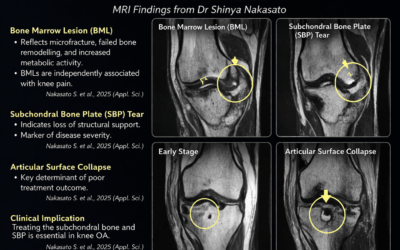 Regenerative Medicine Knee OA